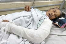 Bác sĩ Bệnh viện Việt Đức kêu gọi giúp đỡ lao động chính 90 tuổi bị tai nạn