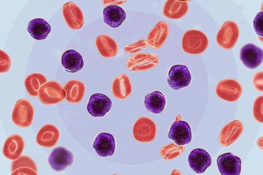 Những điều cần biết về bệnh bạch cầu nguyên bào lympho cấp