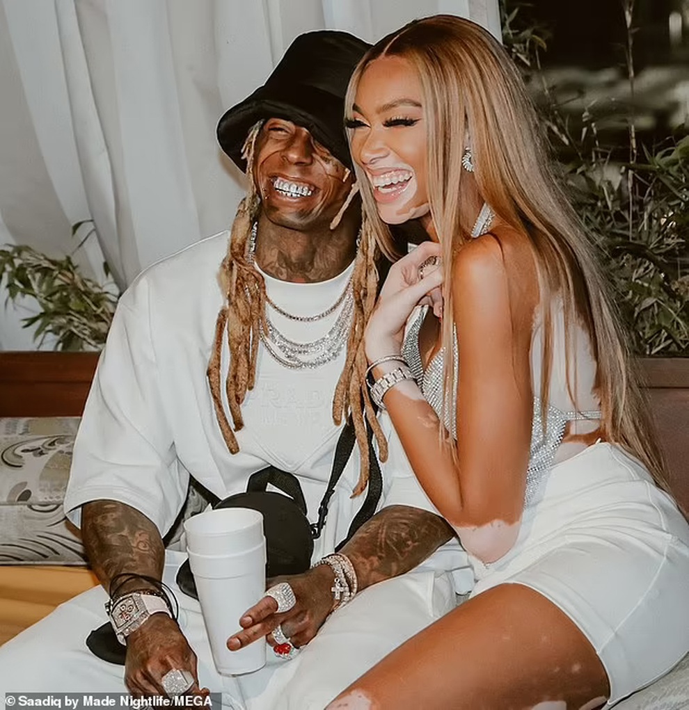 Siêu mẫu bạch biến Winnie Harlow mặc váy hở bạo đón tuổi 27 - 6 Siêu mẫu bạch biến Winnie Harlow mặc váy hở bạo đón tuổi 27 - 6