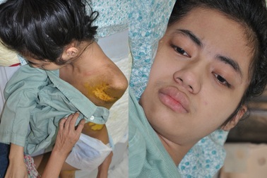 Số phận nghiệt ngã của nữ sinh lớp 11 bị xe tải cán qua người