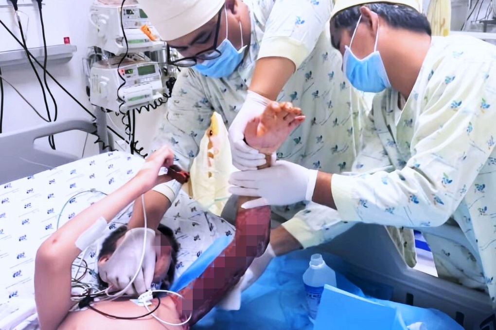 Bé trai người Nga bị tai nạn nguy kịch và cuộc níu mạng đặc biệt ở Việt Nam - 2 Bé trai người Nga bị tai nạn nguy kịch và cuộc níu mạng đặc biệt ở Việt Nam - 2