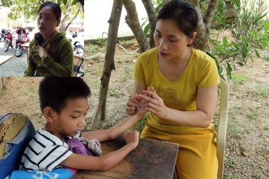 Tình cảnh đáng thương của cậu bé 8 tuổi bị bại não