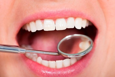 90% người dân Việt gặp vấn đề về răng miệng