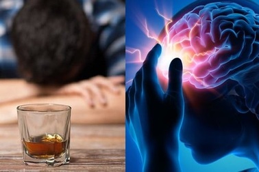 Người đàn ông 40 tuổi đã chảy máu não chỉ vì mê uống rượu