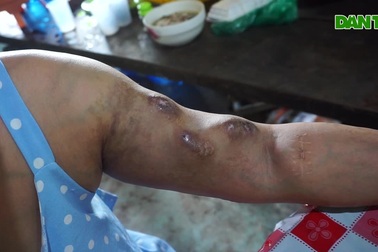 Cả già cả gia đình mắc bệnh hiểm nghèo, rao bán nhà để lấy tiền mua thuốc