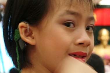 TPHCM: Miễn phí cấy ốc tai điện tử cho trẻ dưới 7 tuổi