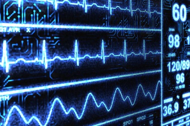 Công cụ AI "siêu phàm" phát hiện bệnh tim chỉ trong chưa đầy 2 giây