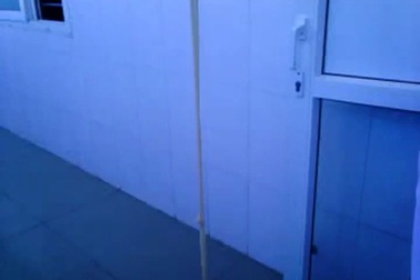 Mục sở thị con sán xơ mít dài 5m trong bụng cụ bà 82 tuổi