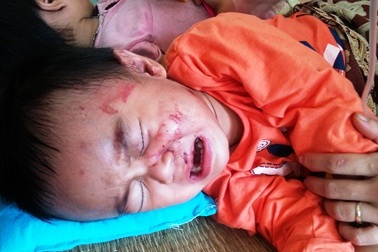 Bị tai nạn giao thông, cả gia đình điều trị trong túng quẫn