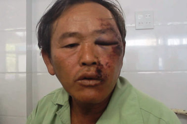 Lexus biển tứ quý tông chết 4 người đội di quan: Tai họa ập xuống những mảnh đời nghèo!