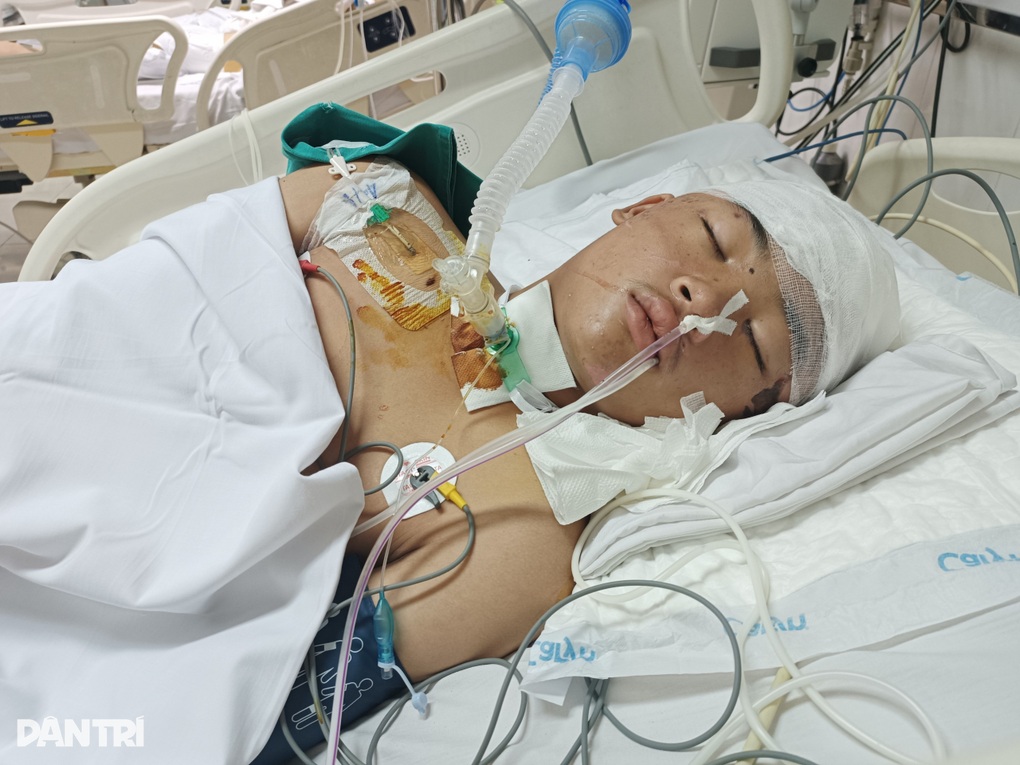 Bị xe bán tải tông trên đường đến lớp, tính mạng cậu bé lớp 8 nguy kịch - 2 Bị xe bán tải tông trên đường đến lớp, tính mạng cậu bé lớp 8 nguy kịch - 2