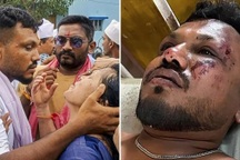 Người sống sót vụ rơi máy bay 260 người chết ở Ấn Độ đang điều trị tâm thần