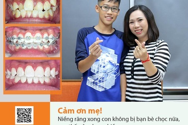 Cho con niềng răng trong độ tuổi vàng, mẹ đảm vô cùng hài lòng vì kết quả