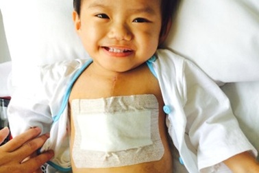 Phẫu thuật thành công bé 5kg bị bệnh tim bẩm sinh phức tạp