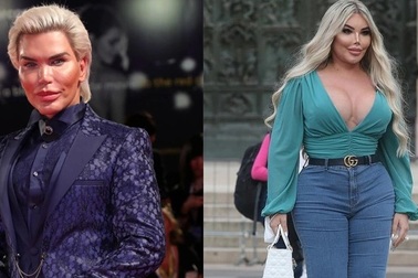 Jessica Alves mất hết hợp đồng quảng cáo sau khi chuyển giới thành phụ nữ