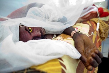 Nguy cơ bùng phát đại dịch sốt vàng da trên thế giới