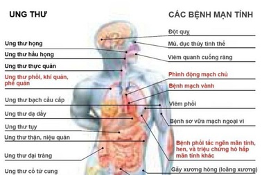Hút thuốc lá, nguy cơ mắc ung thư phổi cao gấp hàng chục lần
