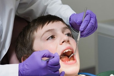 Tư vấn chuyên gia: Phương pháp niềng răng sớm