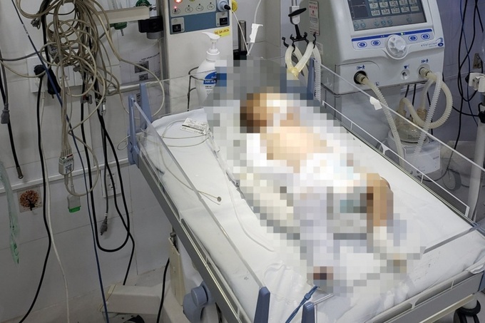 Bé gái đang điều trị tại bệnh viện sau khi bị bạo hành.