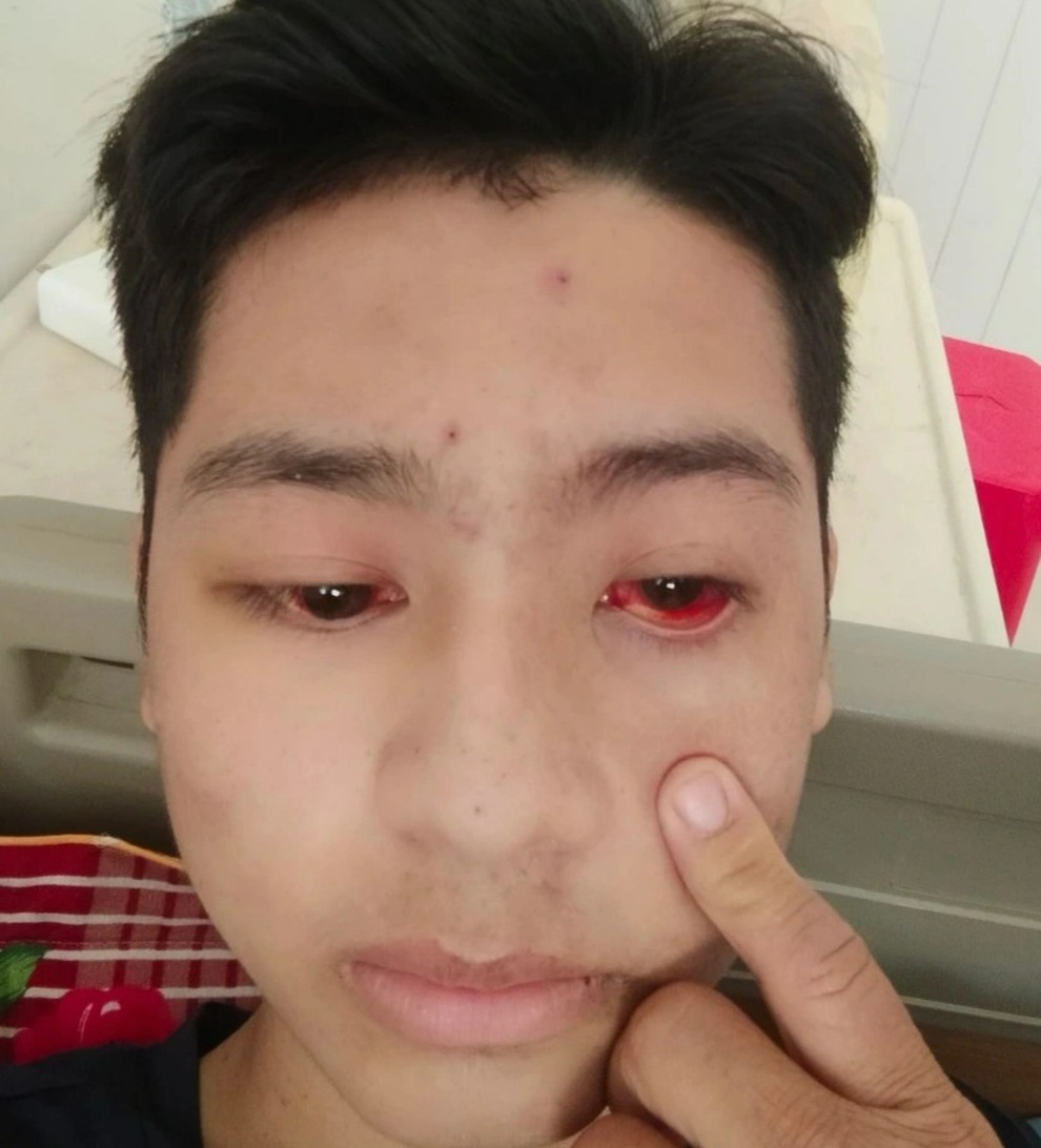 Xót xa cảnh chàng trai chết mòn, gần 2 tháng không có tiền đến viện - 3 Xót xa cảnh chàng trai chết mòn, gần 2 tháng không có tiền đến viện - 3