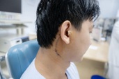 Sợ phẫu thuật liệt mặt, chàng trai mang khối u lớn sang Việt Nam cầu cứu