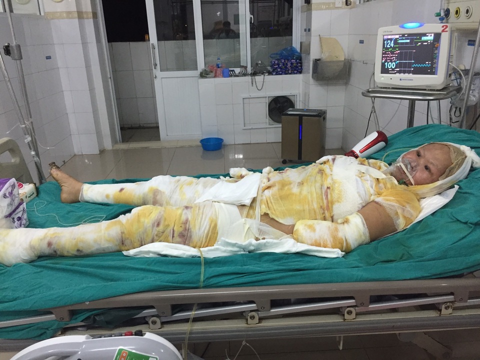 Người vợ trẻ bị điện giật khi đi hái mít đã qua cơn nguy kịch - 2 Người vợ trẻ bị điện giật khi đi hái mít đã qua cơn nguy kịch - 2