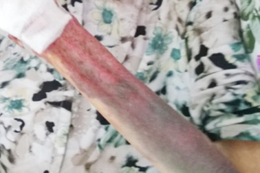 Cụ bà 94 tuổi bị con ruột đánh nhập viện