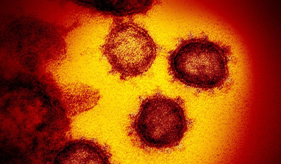 Nghiên cứu: Virus corona có thể đã lây ở người hàng chục năm - 2 Nghiên cứu: Virus corona có thể đã lây ở người hàng chục năm - 2