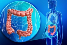 Có thể ngăn ngừa ung thư đại trực tràng không?