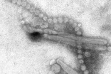 Cúm H7N9 là tổ hợp gen của nhiều vi rút khác nhau
