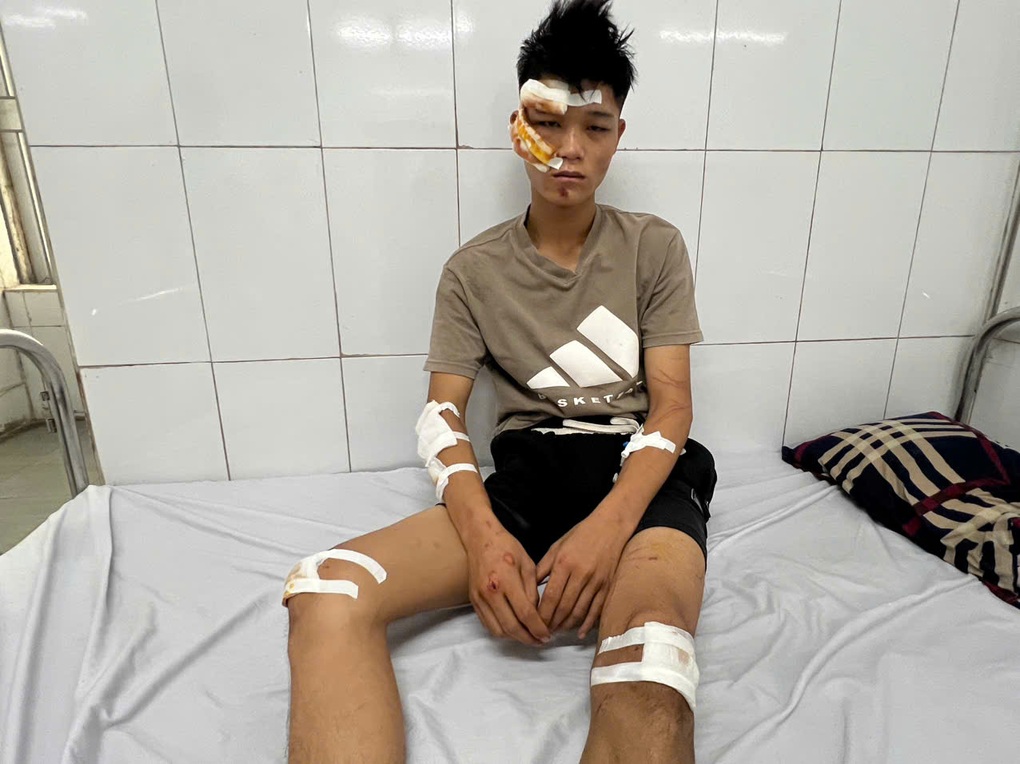Quái xế đâm đại úy CSCĐ: Vi phạm giao thông nên lao qua chốt để bỏ chạy - 1 Quái xế đâm đại úy CSCĐ: Vi phạm giao thông nên lao qua chốt để bỏ chạy - 1