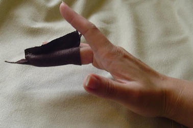 Cách sơ cứu hiệu quả khi vô tình bị đứt lìa ngón tay