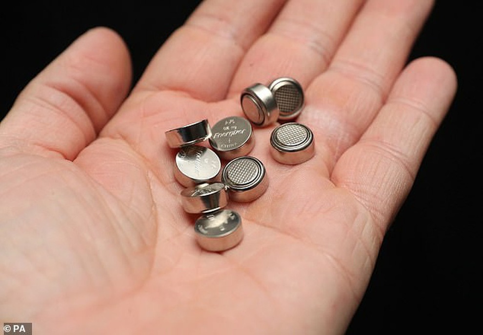 Gắp thành công viên pin cúc từ thực quản bé gái 3 tuổi - 2 Gắp thành công viên pin cúc từ thực quản bé gái 3 tuổi - 2