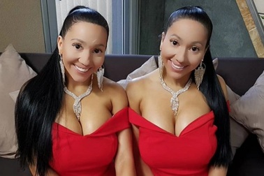 "Cặp song sinh giống nhau nhất thế giới" suýt chết một người vì làm đẹp