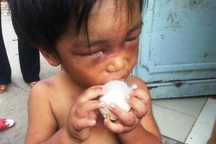 Cháu bé 3 tuổi bị cậu đánh đập dã man, bắt đi ăn xin