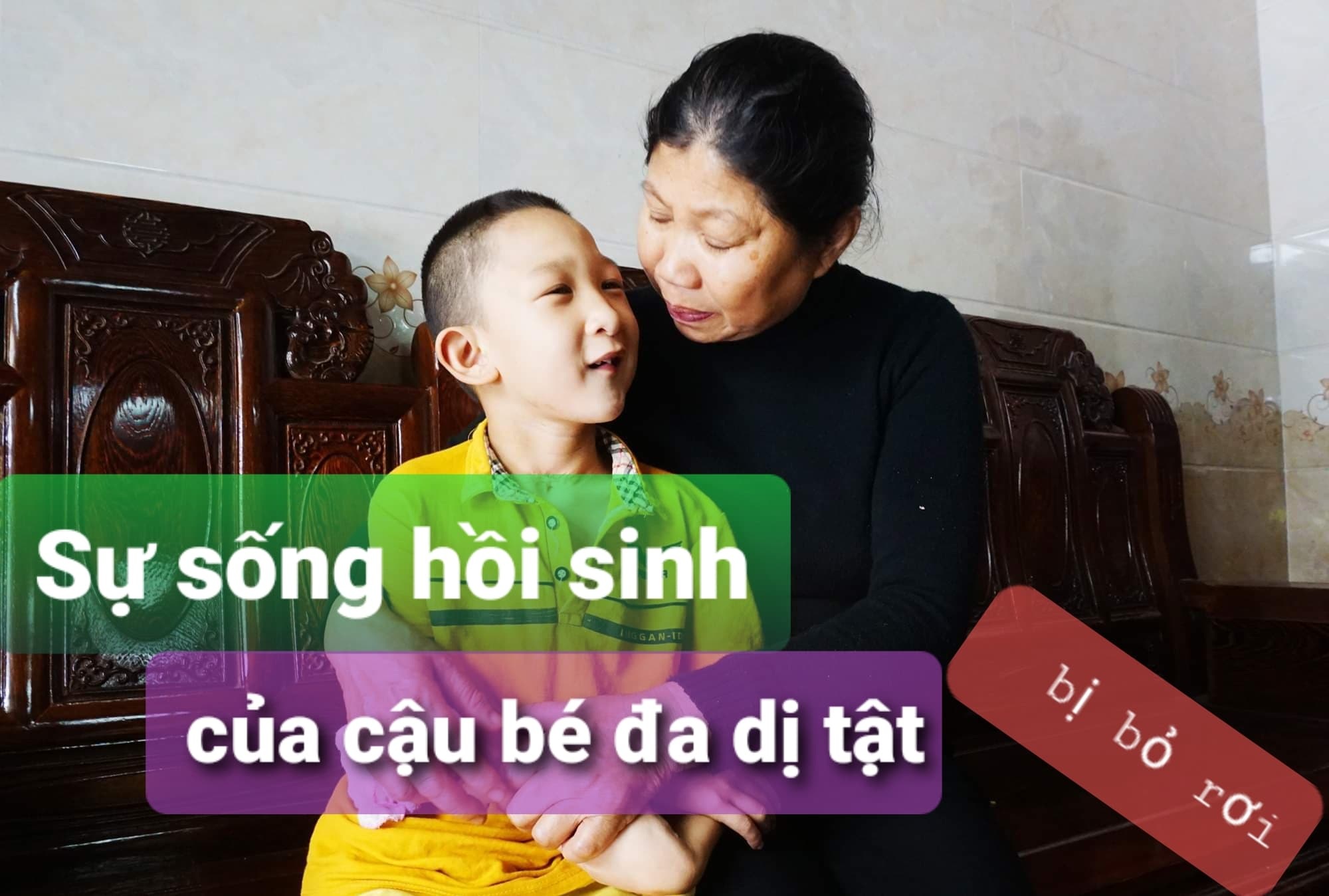 Hành trình hồi sinh đầy gian nan của cậu bé đa dị tật 2 lần bị bỏ rơi