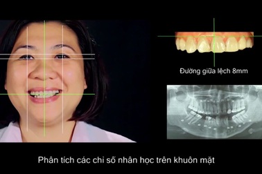 Hành trình đi tìm nụ cười rạng rỡ