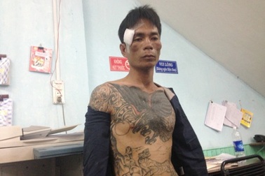 Vụ nổ súng trấn áp tội phạm: Một mảnh đạn trúng người đi đường