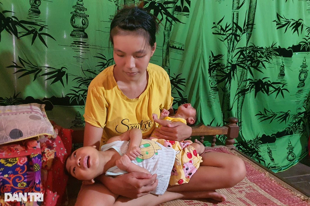 Nỗi đau người mẹ sống như đã chết khi có 2 con mắc bệnh teo não bẩm sinh - 4 Nỗi đau người mẹ sống như đã chết khi có 2 con mắc bệnh teo não bẩm sinh - 4