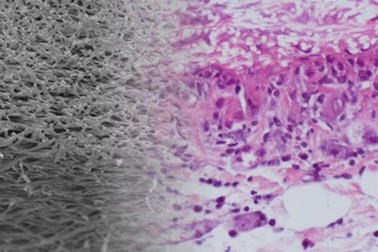 Thử nghiệm thành công mạch máu nhân tạo