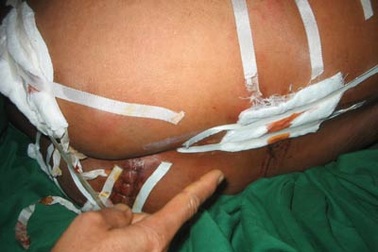 Nhóm côn đồ chém người điên cuồng trong đám cưới