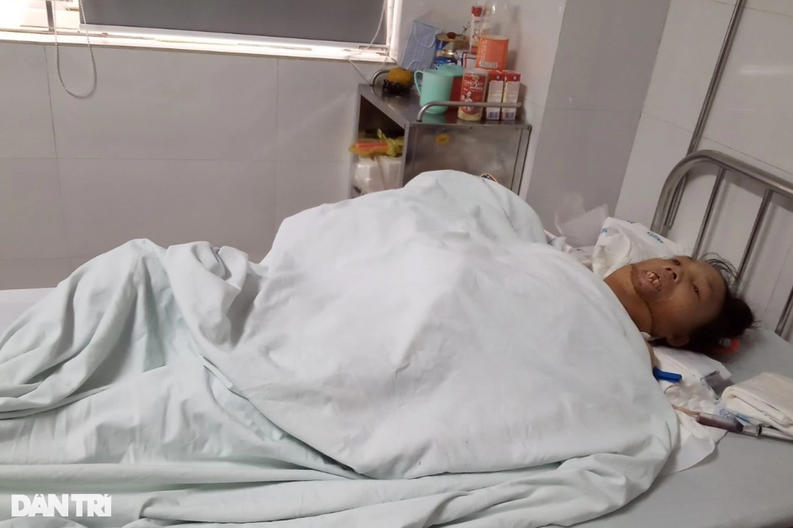 Người đàn bà 33 năm không được mang gương mặt con người được phẫu thuật - 1 Người đàn bà 33 năm không được mang gương mặt con người được phẫu thuật - 1