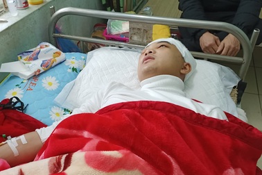 Sở GD&ĐT ra văn bản chấn chỉnh sau vụ nam sinh bị đánh vỡ sọ não