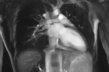 Cơ thể con người cực lạ qua các công nghệ chụp, quét y học hiện đại