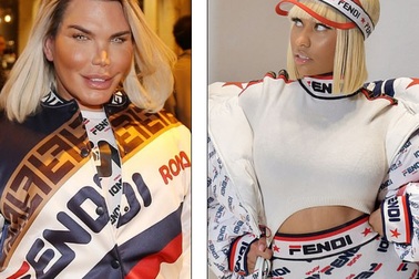 "Búp bê Ken" Rodrigo Alves tiếp tục phẫu thuật thẩm mỹ