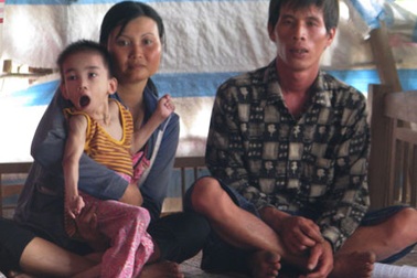 Gia cảnh ngặt nghèo của bé gái 11 tuổi chỉ nặng 7kg