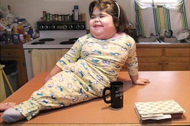 Cô bé "người cá" qua đời 