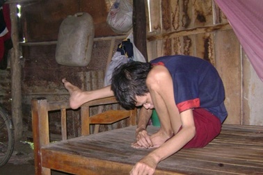 Chung tay hỗ trợ nạn nhân chất độc da cam