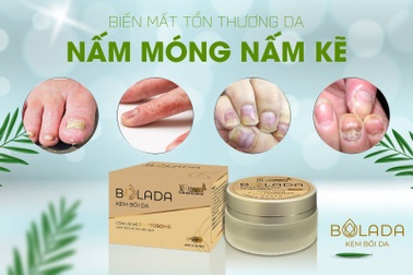 Kem bôi da Bolada - bí quyết vàng cho làn da