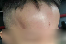 Đà Nẵng xác minh việc phụ huynh tố trẻ bị bạo hành ở trường